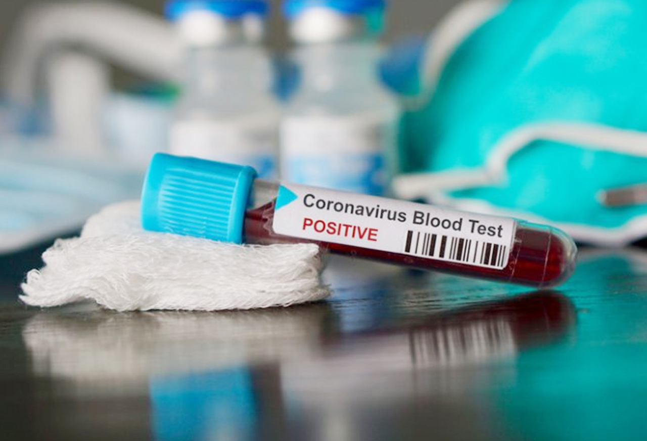 How to be positive in the Coronavirus fear